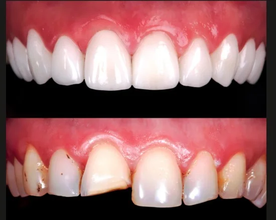 Odontologia estética